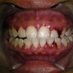 Bolavé zuby dokážou potrápit